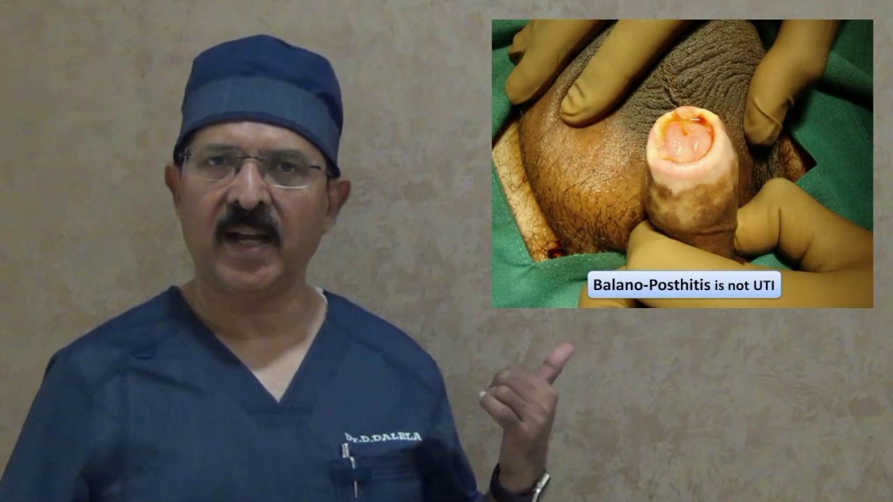 christopher michelle recommends finger in urethra pic