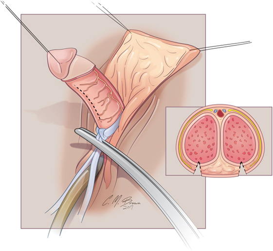 abo mahmoud recommends large clitoris photos pic