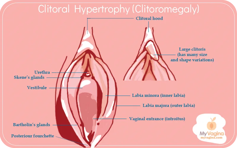 biggest clitoris pics