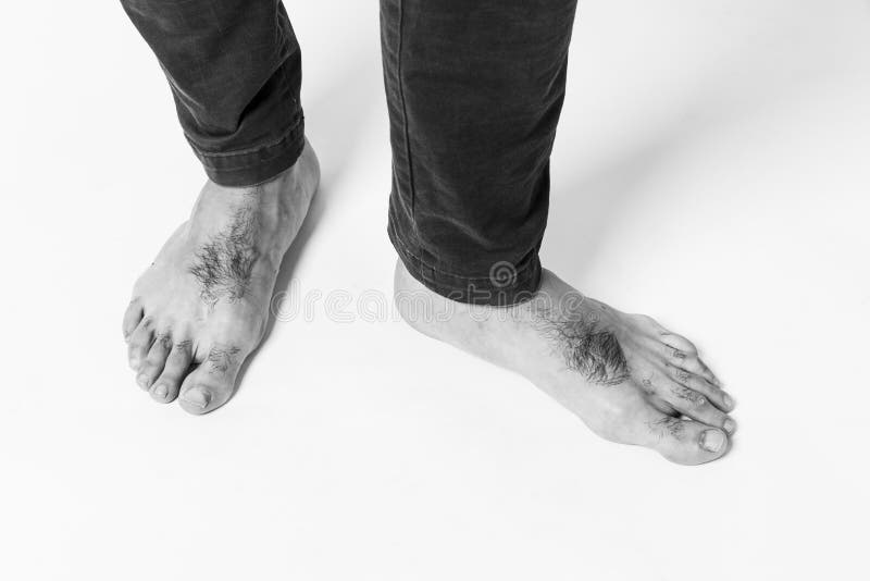 bran lim share hairy men feet photos