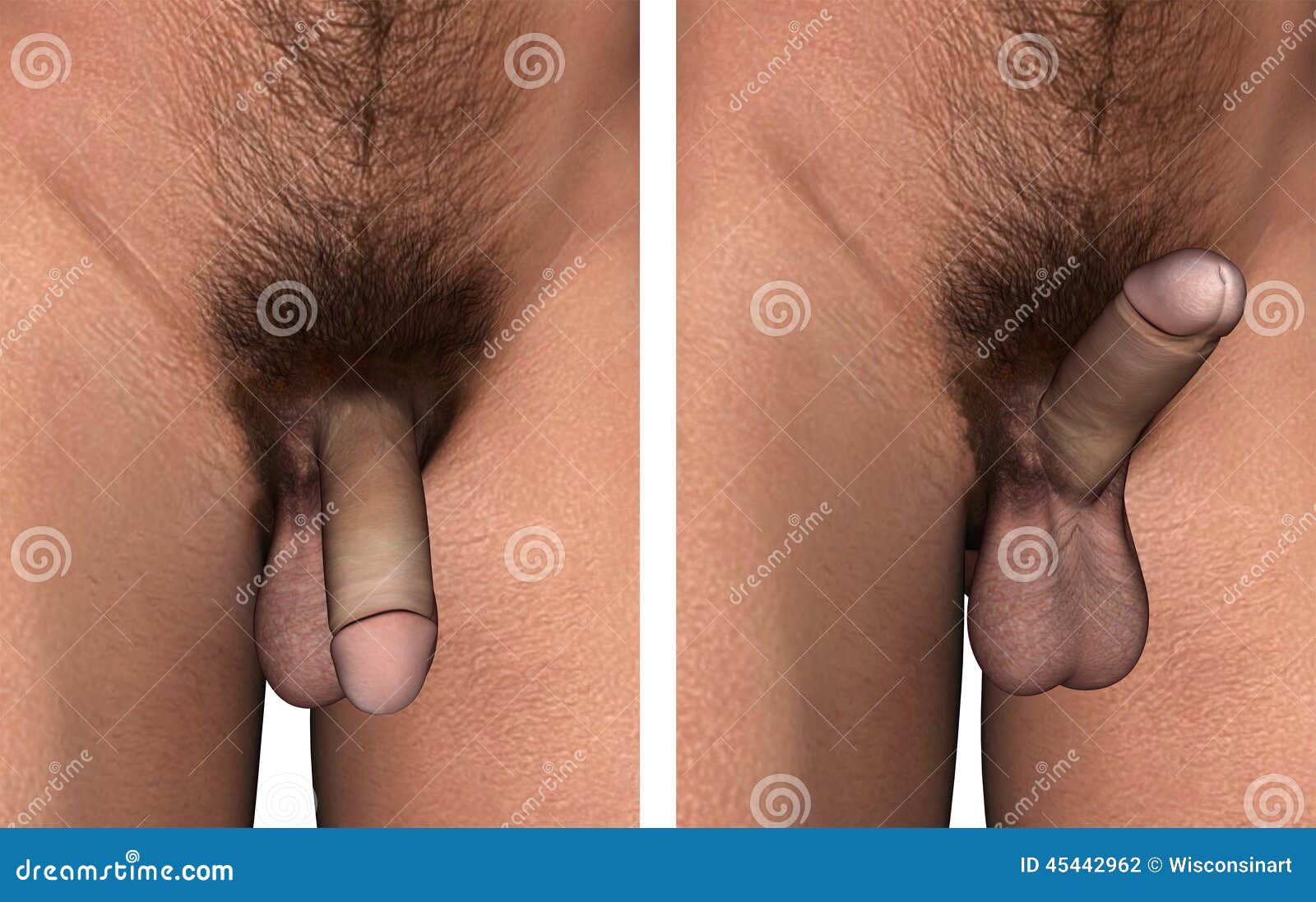 male erection pics